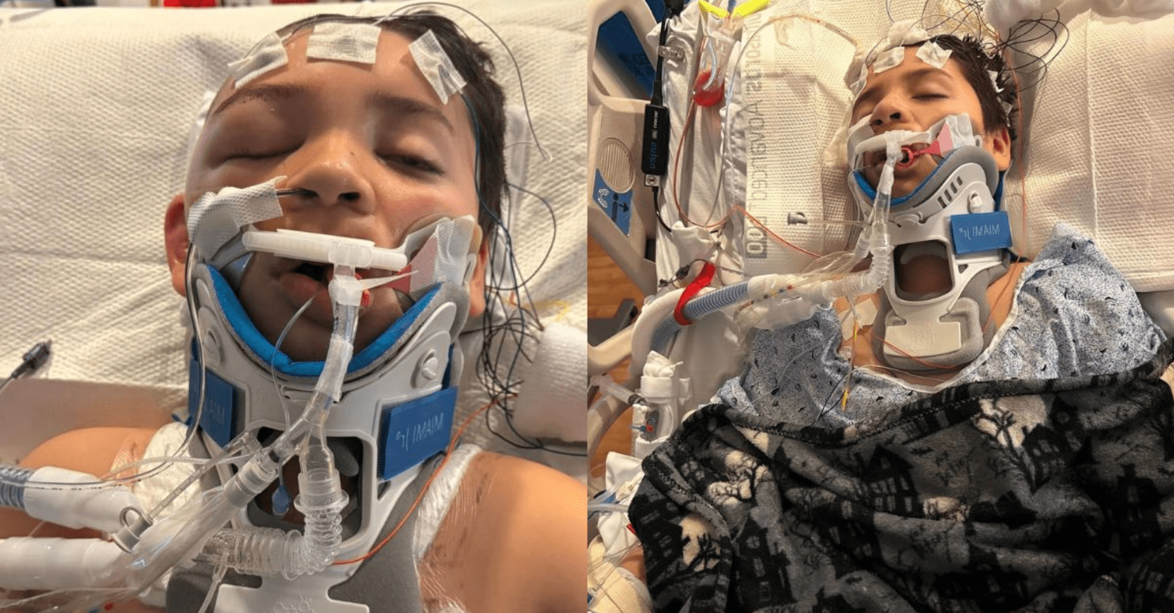 Mom Outraged After Son Lenny Suffers Skull Fracture in Gym Class Assault School Waited Hours to Call Police and Let Attacker Return to Class